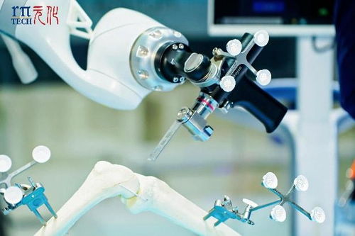 科技賦能醫(yī)療新未來 元化智能錕铻全骨科手術(shù)機器人閃耀進博會